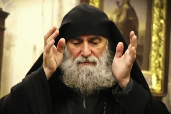 «Голова болит?! Радоваться нужно – значит, мозг в голове есть!»